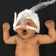 Neonato